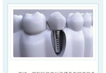 即刻種植：不是你想種就能種！