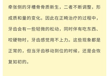關(guān)于牙齒矯正的那些事兒